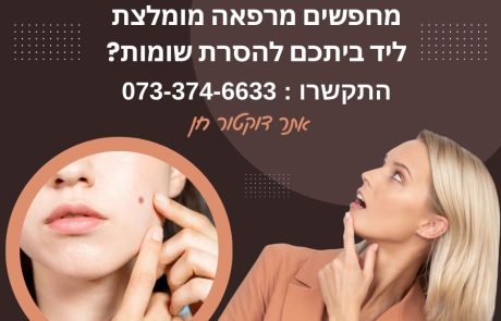 הסרת שומות – הדרך הקלה למציאת המרפאה המומלצת ליד ביתכם