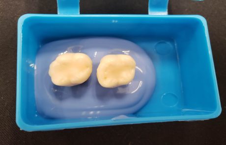 חוקרים בישראל פיתחו ננו-מבנים אנטי-בקטריאליים שניתן לשלבם בחומרים לשחזור שיניים