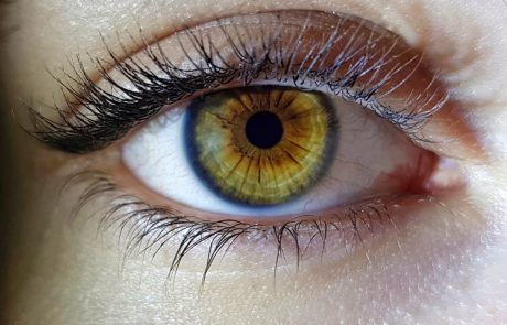 מה עדיף לקרטוקונוס מתקדם — עדשות קשות או סקלרליות?