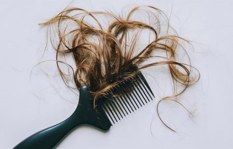 SKCURE בבדיקה מעמיקה: מתי נשירת שיער כבר דורשת טיפול רציני