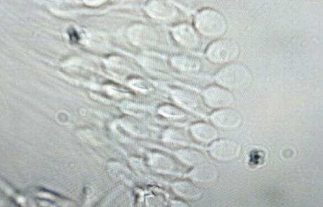 בדיקת DNA עוברי – מה אומרת הבדיקה וכיצד היא יכולה לעזור לנו?