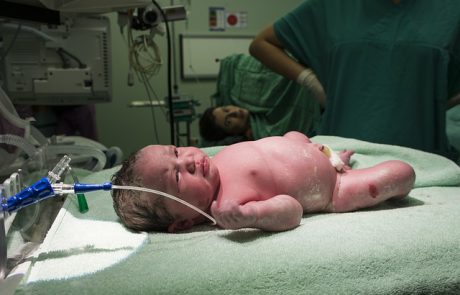 חייהן של יולדת ותינוקת ניצלו בבילינסון לאחר תסחיף מי שפיר