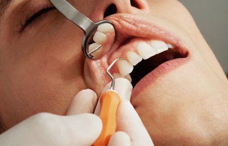 תביעה: רופא השיניים עקר ארבע שיניים ללא סיבה. המטופלת תובעת פיצויים כבדים