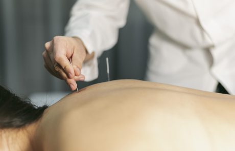 דיקור סיני מול טיפול מערבי בכאבים בפי הטבעת – מה עדיף?