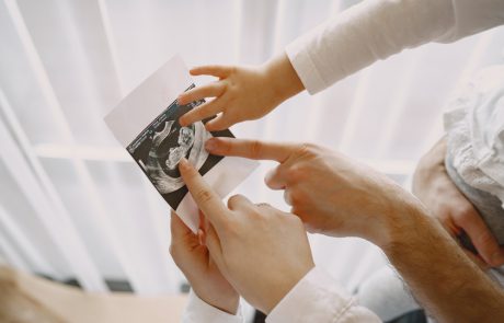 סקירת מערכות מורחבת – המדריך המלא