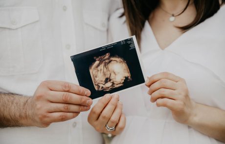 מחקר חדש מצביע: ניתן לזהות סימנים מוקדמים לאוטיזם כבר באולטרסאונד טרום לידתי